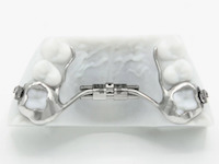 palatal expander